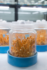 Les raisons de la dysfonction érectile chez l'homme